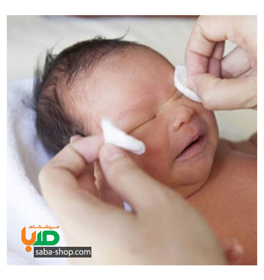 درمان عفونت چشم نوزاد