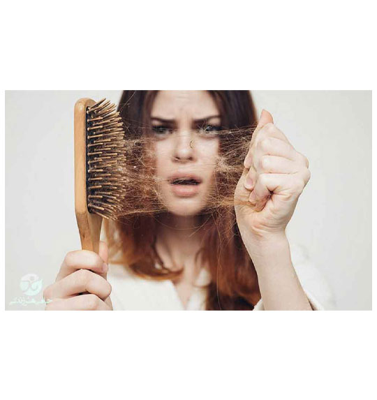 درمان ریزش موی خانم ها در دوره شیردهی