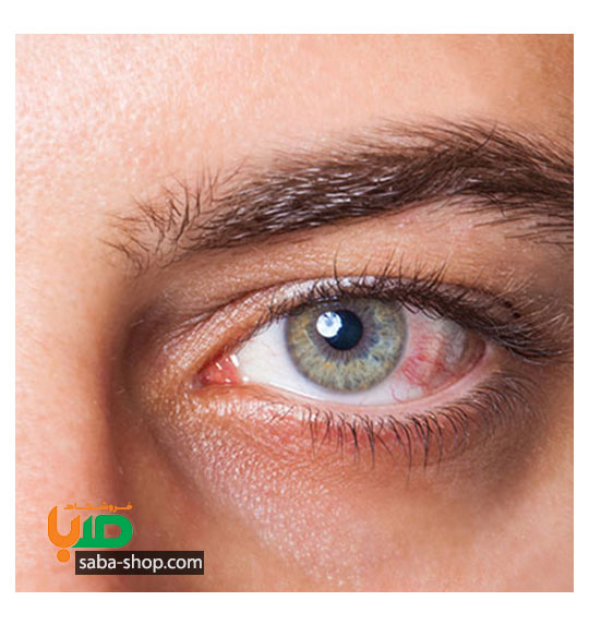 درمان لکه های داخل چشم